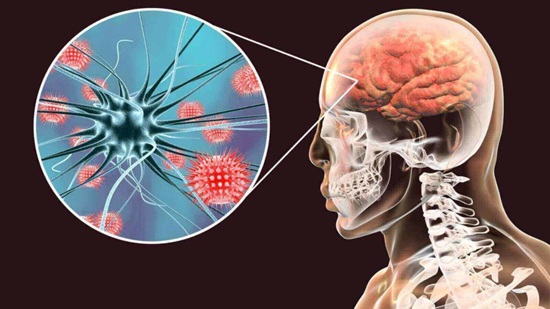 tipos de meningitis