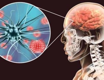 causas, sintomas y tratamiento contra la meningitis